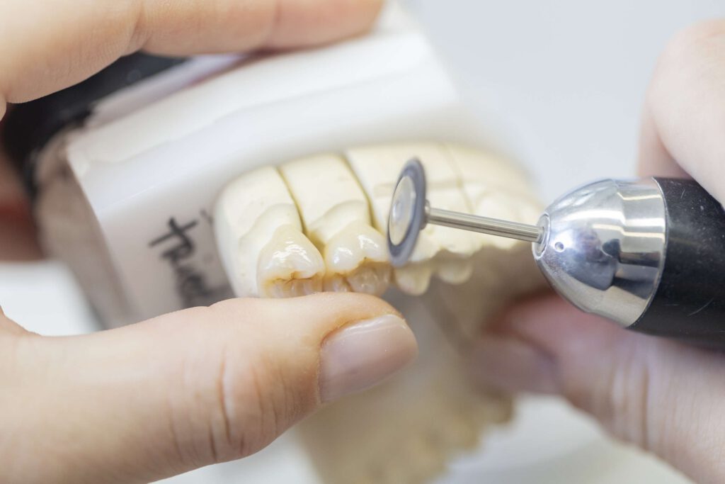 Modell eines Gebisses wird in Zahnarztpraxis bearbeitet.